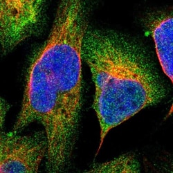 PLAP Antibody, Novus Biologicals:Antibodies:Primary Antibodies
